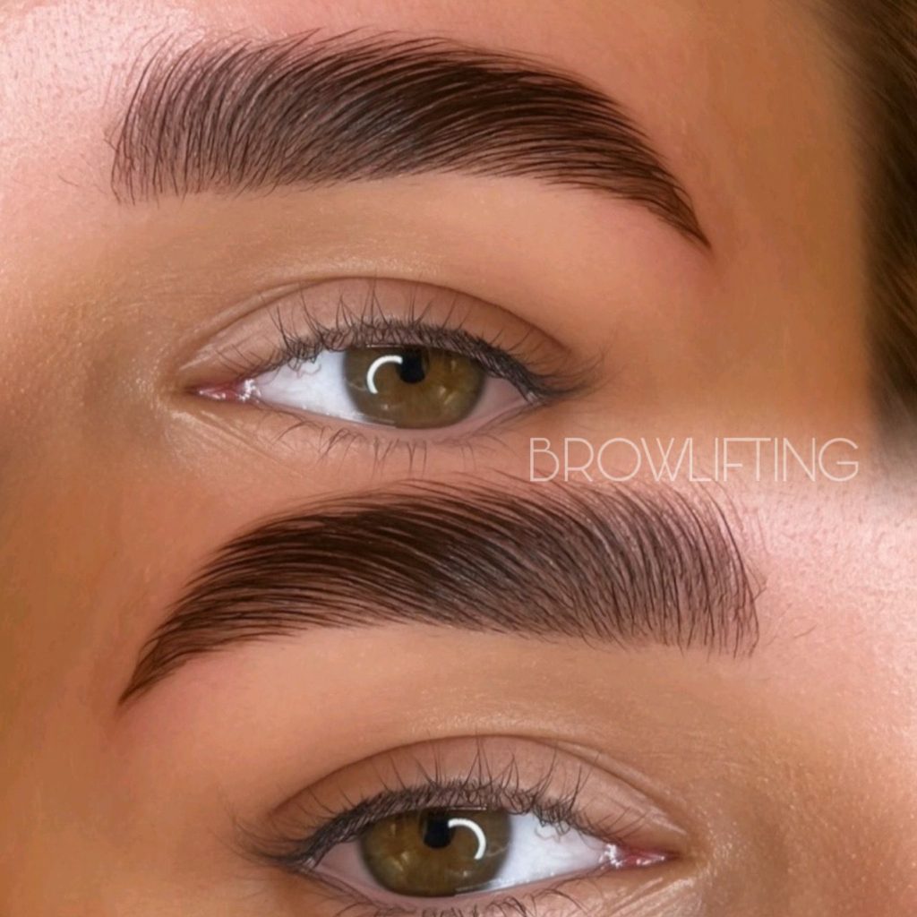 Browlifting
